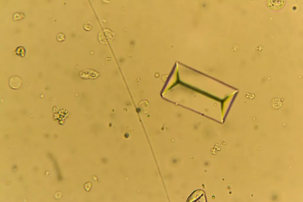 Struvitni kristali pod mikroskopom